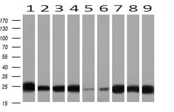 Flow Cytometry: IgJ Antibody (OTI3B3) [NBP2-01688] - Western blot analysis of extracts (10ug) from 9 Human tissues by using NBP2-06188 at 1:200 (1: Testis; 2: Omentum; 3: Uterus; 4: Breast; 5: Brain; 6: Liver; 7: Ovary; 8: Thyroid gland; 9: Colon).