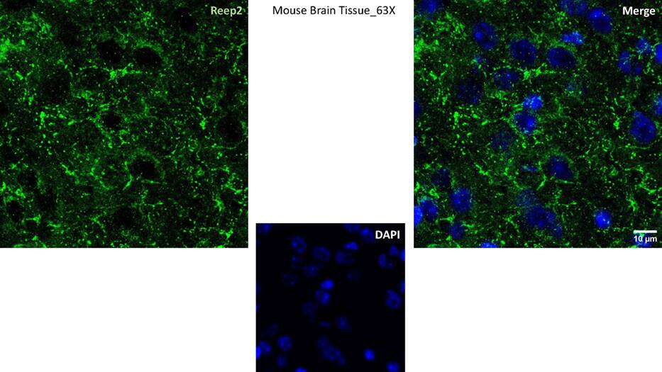 Mouse was perfused with PFA, and brain sections were prepared using a cryosectioning method. The primary antibody for IF was used at a dilution ratio of 1:50. Image from a verified customer review.