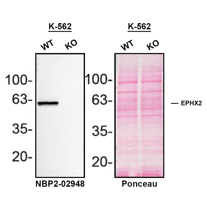<b>Genetic Strategies Validation. </b>Western blot shows lysates of K562 human chronic myelogenous leukemia parental cell line and EPHX2 knockout K562 cell line (KO). Nitrocellulose membrane was probed with EPHX2 Antibody (OTI1A6) (Catalog # NBP2-02948) followed by HRP-conjugated secondary antibody. A specific band was detected for EPHX2 at approximately 62.6 kDa (as indicated) in the parental K562 cell line, but is not detectable in knockout K562 cell line. Primary antibody dilution used: 1/500. The Ponceau stained transfer of the blot is shown. This experiment was conducted under reducing conditions. Image, protocol, and testing courtesy of YCharOS Inc. See ycharos.com for additional details.