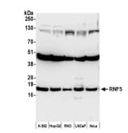 Western Blot: RNF5 Antibody [NBP2-04014] - Whole cell lysate (50 µg) from K-562, Hep-G2, RKO,LNCaP, and HeLa cells prepared using NETN lysis buffer.Antibody: Affinity purified rabbit anti-RNF5 antibody used for WB at 0.4 µg/ml. Detection:Chemiluminescence with an exposure time of 30 seconds