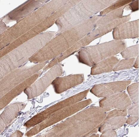 Immunohistochemistry-Paraffin: RPP25L Antibody [NBP2-13259] -Staining of human skeletal muscle shows moderate cytoplasmic positivity in myocytes.
