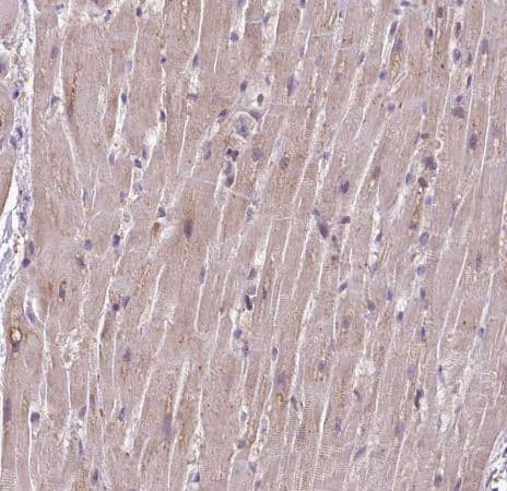 Immunohistochemistry-Paraffin: RPP25L Antibody [NBP2-13259] - Staining of human heart muscle shows moderate cytoplasmic positivity in cardiomyocytes.