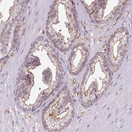 Immunohistochemistry-Paraffin: RPP25L Antibody [NBP2-13259]-Staining of human prostate shows weak cytoplasmic positivity and membranous positivity in glandular cells.