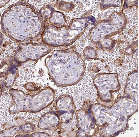 Immunohistochemistry-Paraffin: RPP25L Antibody [NBP2-13259] - Staining of human placenta shows strong cytoplasmic and membranous positivity in trophoblastic cells.