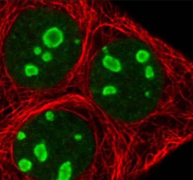 Staining of human cell line MCF7 shows localization to the nucleus & nucleoli.