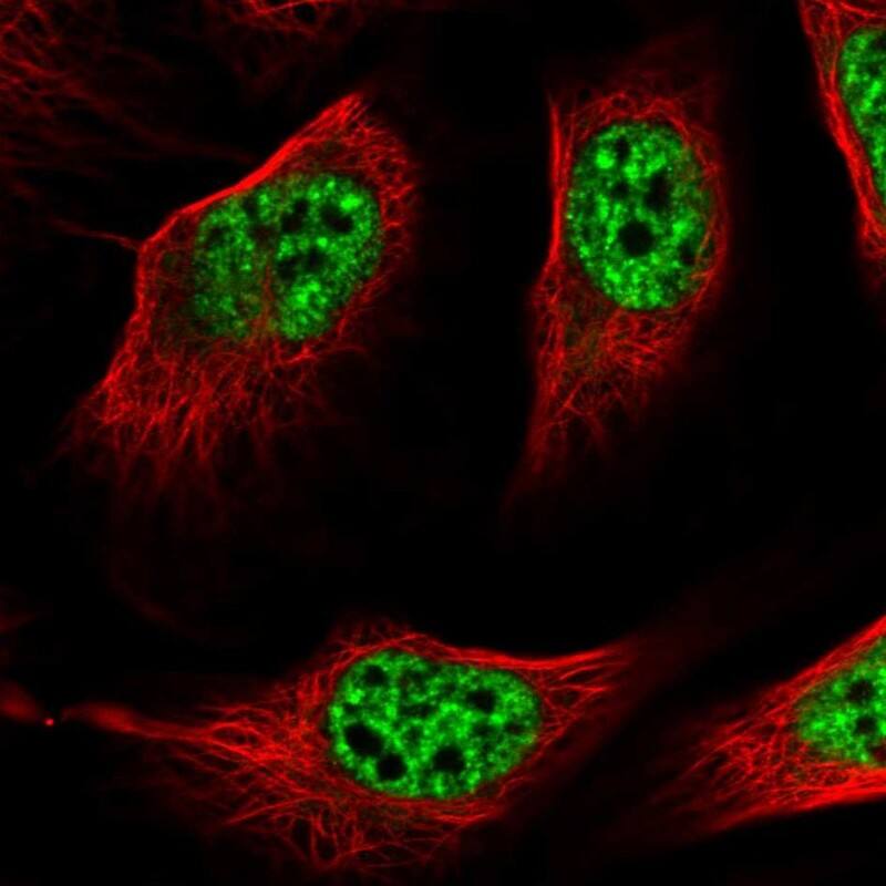 The staining of human cell lines in U-2 OS shows localization to nuclear speckles.