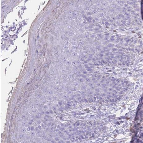 Immunohistochemistry-Paraffin: PSMB5 Antibody [NBP2-13820] - Staining of human skin shows no positivity in squamous epithelial cells as expected.