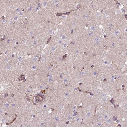 Staining of human cerebral cortex shows moderate cytoplasmic positivity in endothelial cells.