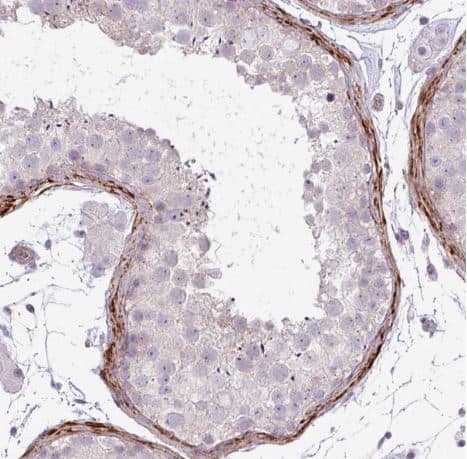 Staining of human testis shows strong cytoplasmic positivity in peritubular myoid cells.