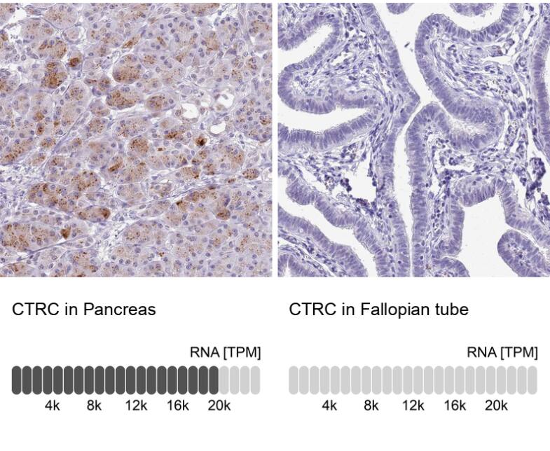Analysis in human pancreas and fallopian tube tissues using NBP2-13882 antibody. Corresponding CTRC RNA-seq data are presented for the same tissues.