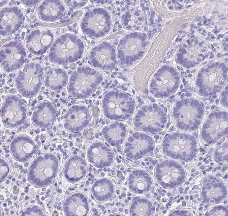  Staining of human duodenum shows no positivity in glandular cells as expected.