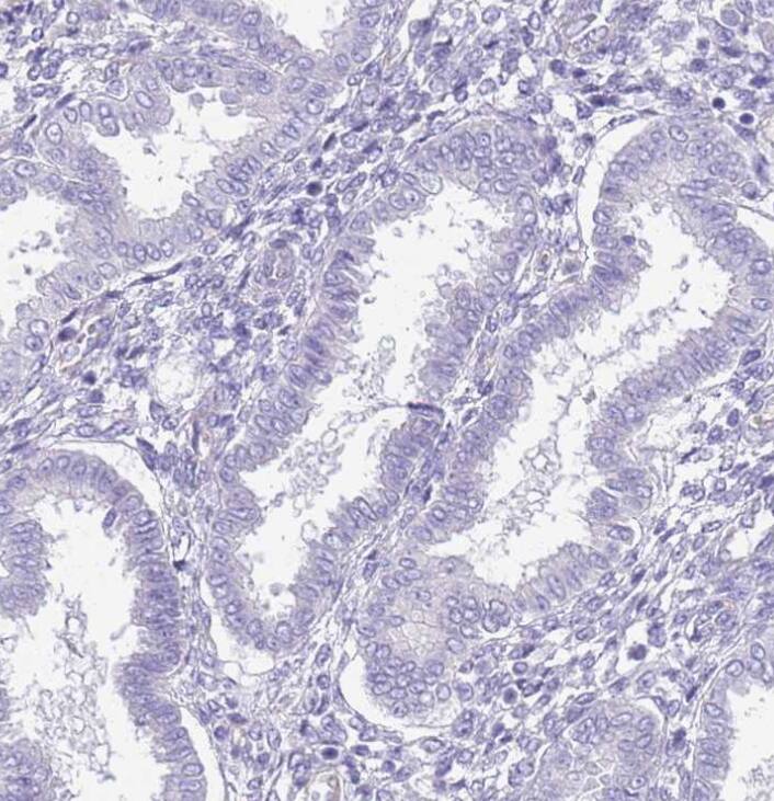 Staining of human endometrium shows no positivity in glandular cells as expected.
