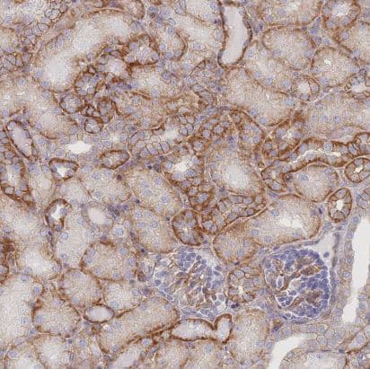 Immunohistochemistry-Paraffin: G protein beta 4 Antibody [NBP2-14060] -Staining of human kidney shows strong membranous positivity in cells in tubules.