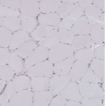 Immunohistochemistry-Paraffin: G protein beta 4 Antibody [NBP2-14060] -staining of human skeletal muscle shows no positivity in myocytes as expected.