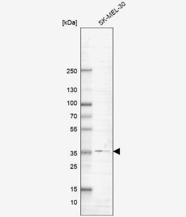 Western Blot: G protein beta 4 Antibody [NBP2-14060] -Analysis in human cell line SK-MEL-30.