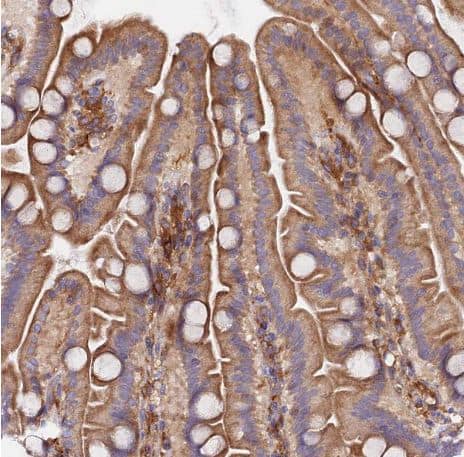 Staining of human small intestine shows moderate cytoplasmic and membranous positivity in glandular cells.