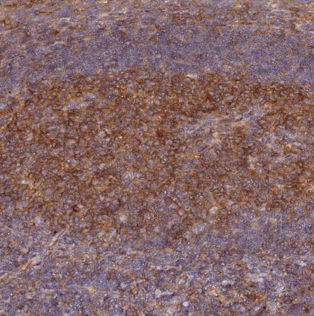 Staining of human tonsil shows moderate cytoplasmic and membranous positivity in germinal center cells.