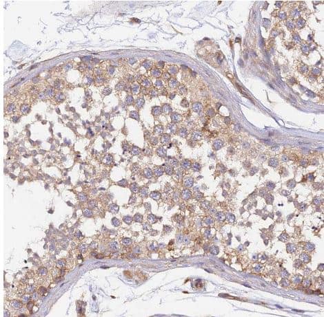 Staining of human testis shows weak cytoplasmic and membranous positivity in cells in seminiferous ducts.