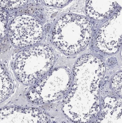 Immunohistochemistry-Paraffin: 5-HT4 Antibody [NBP2-14109] - Staining of human testis shows no positivity in cells in seminiferous ducts as expected.