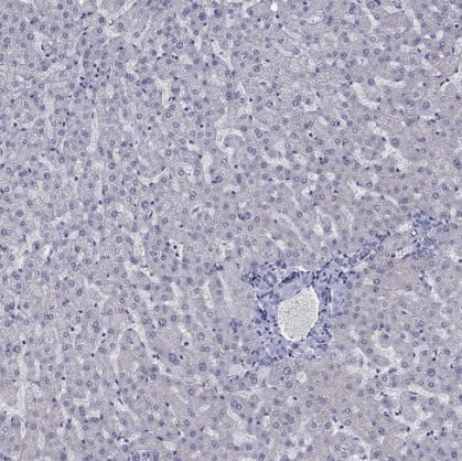 Immunohistochemistry-Paraffin: 5-HT4 Antibody [NBP2-14109] - Staining of human liver shows no positivity in hepatocytes as expected.