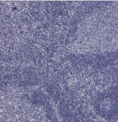 Immunohistochemistry-Paraffin: 5-HT4 Antibody [NBP2-14109] -  Staining of human tonsil shows no positivity in germinal and non-germinal center cells as expected.