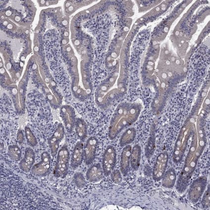 Immunohistochemistry-Paraffin: 5-HT4 Antibody [NBP2-14109] - Staining of human small intestine shows strong cytoplasmic positivity in enteroendocrine cells.