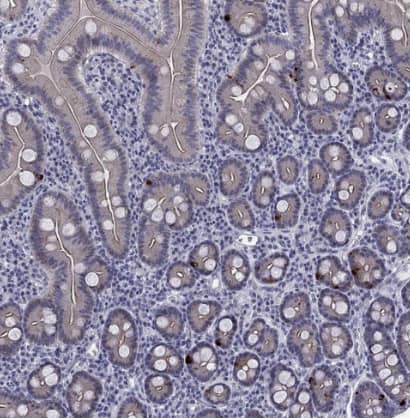 Immunohistochemistry-Paraffin: 5-HT4 Antibody [NBP2-14109] - Staining of human duodenum shows strong cytoplasmic positivity in enteroendocrine cells.