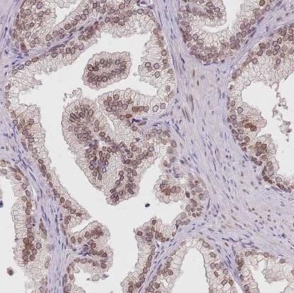 Immunohistochemistry-Paraffin KLHDC2 Antibody