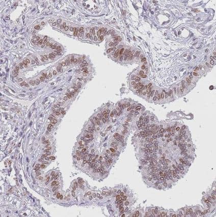 Immunohistochemistry-Paraffin KLHDC2 Antibody