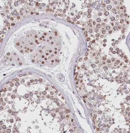 Immunohistochemistry-Paraffin KLHDC2 Antibody