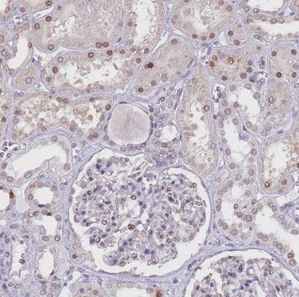 Immunohistochemistry-Paraffin: KLHDC2 Antibody [NBP2-14163] - Staining of human kidney shows moderate nuclear/nuclear membranous positivity in cells in tubules.