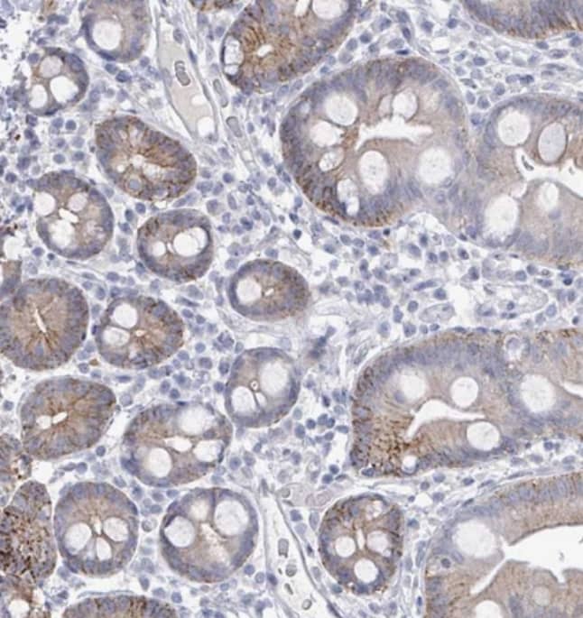 Staining of human small intestine shows weak granular cytoplasmic positivity in glandular cells.