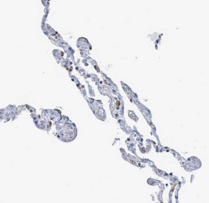  Staining of human lung shows weak granular cytoplasmic positivity in subset of pneumocytes.