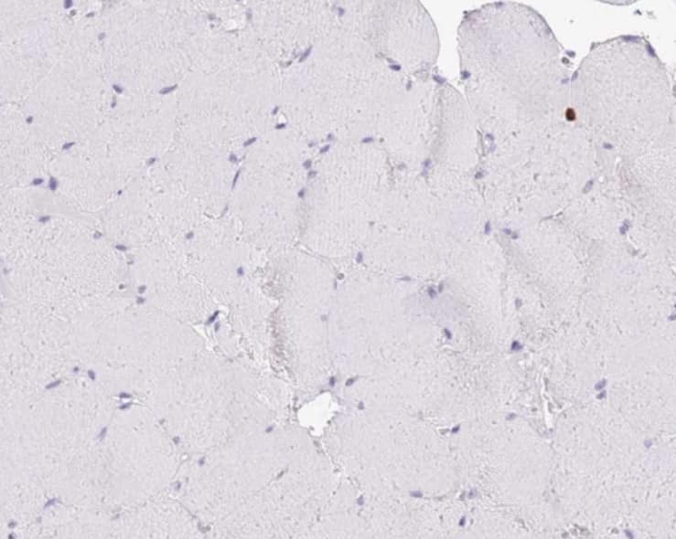 Staining of human skeletal muscle shows no positivity in myocytes as expected.