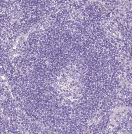 Staining of human lymph node shows no positivity in germinal center cells as expected.