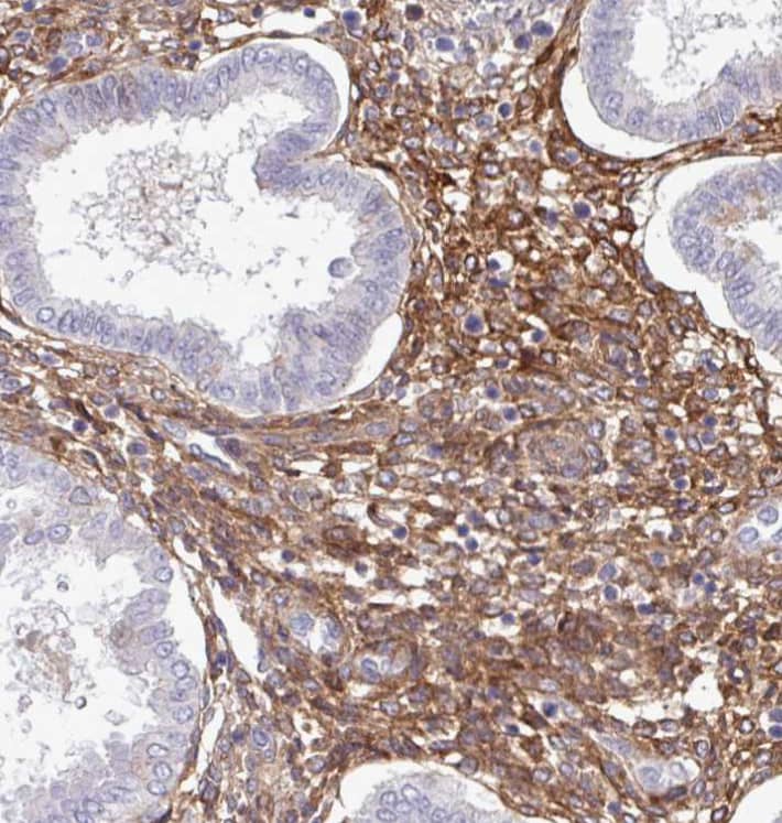 Staining of human endometrium shows strong membranous positivity in stromal cells.