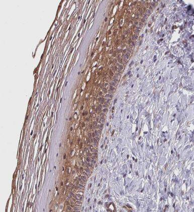 Immunohistochemistry-Paraffin: TRABD2B Antibody- [NBP2-14558] - Staining of human cervix, uterine shows moderate cytoplasmic positivity in squamous epithelial cells.