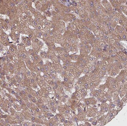 Immunohistochemistry-Paraffin: TRABD2B Antibody- [NBP2-14558]- Staining of human liver shows moderate cytoplasmic positivity in hepatocytes.
