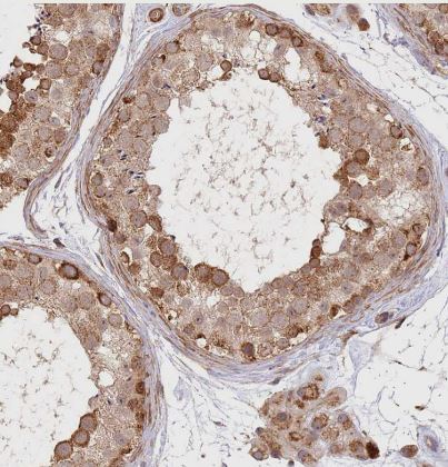 Immunohistochemistry-Paraffin UQCC3 Antibody - BSA Free