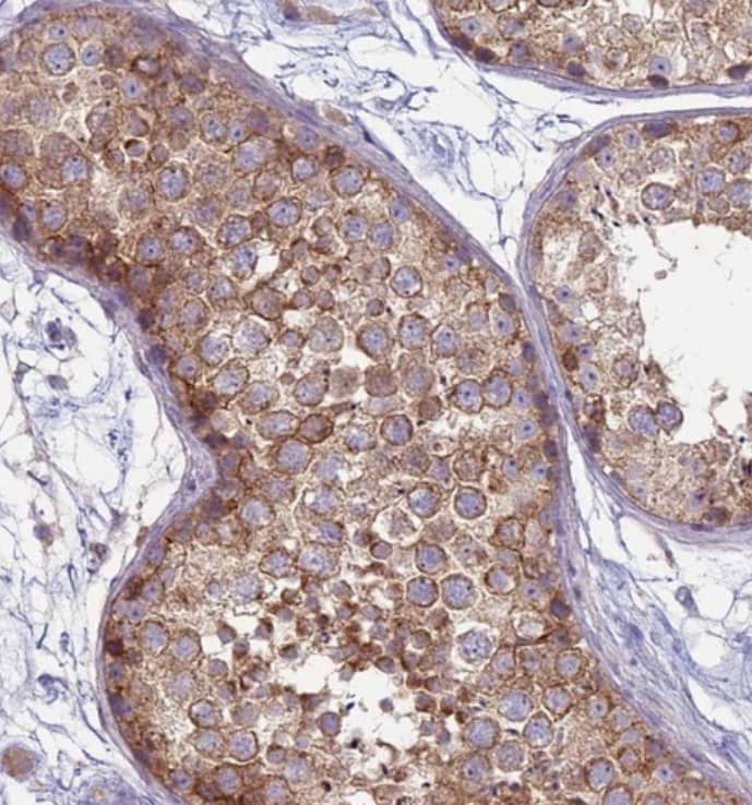 Staining of human testis shows strong cytoplasmic positivity in cells in seminiferous ducts.