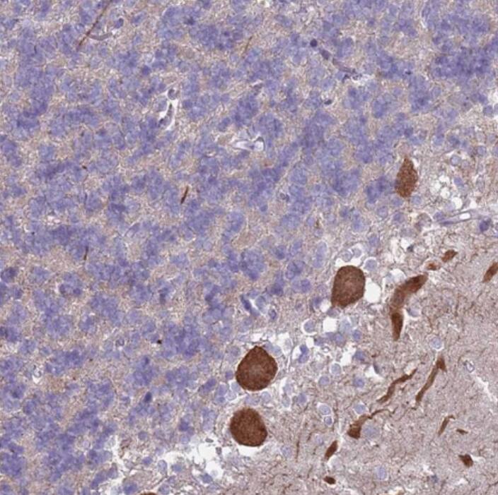 Staining of human cerebellum shows strong cytoplasmic positivity in Purkinje cells.