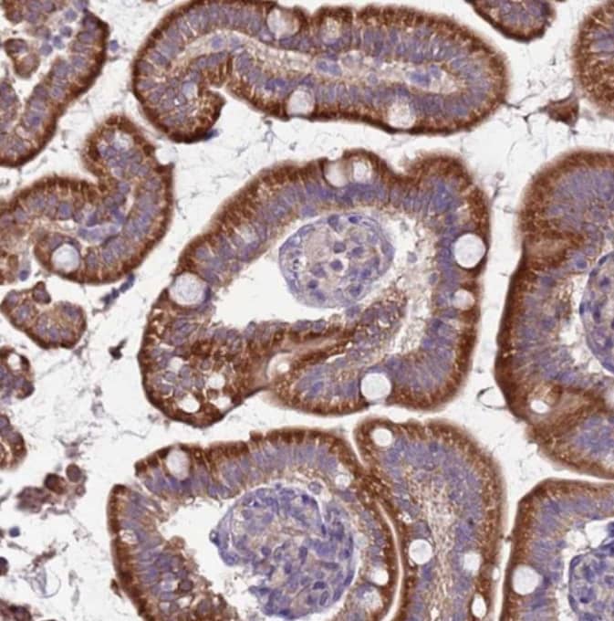 Staining of human small intestine shows moderate cytoplasmic positivity in glandular cells.