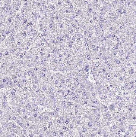 Staining of human liver shows no positivity in hepatocytes as expected.