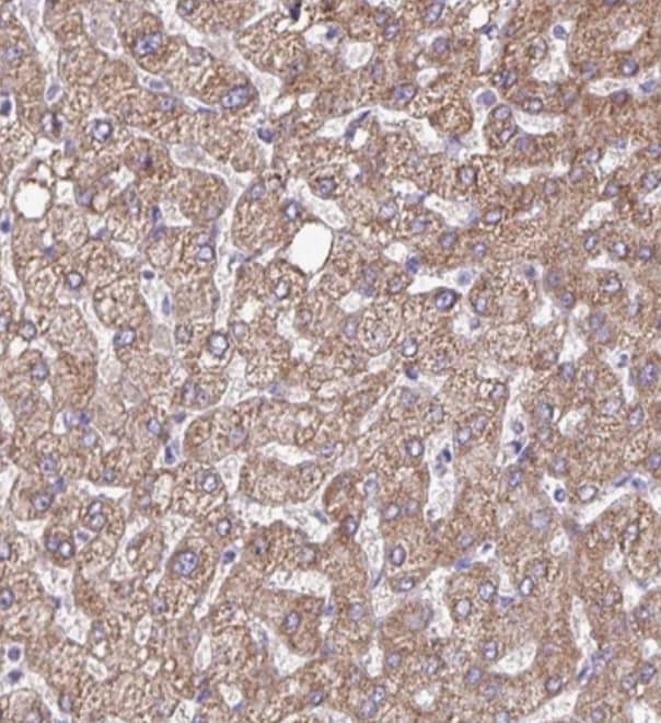  Staining of human liver shows strong cytoplasmic granular positivity in hepatocytes.