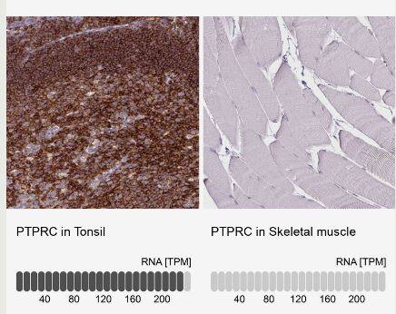 Immunohistochemistry-Paraffin: CD45 Antibody (CL0160) [NBP2-14783] -Analysis in human tonsil and skeletal muscle tissues using NBP2-14783 antibody. Corresponding PTPRC RNA-seq data are presented for the same tissues.