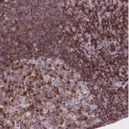 Immunohistochemistry-Paraffin: CD45 Antibody (CL0160) [NBP2-14783] -Staining of human lymph node shows moderate to strong membranous positivity in lymphoid cells.