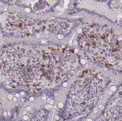 Immunohistochemistry-Paraffin: CD45 Antibody (CL0160) [NBP2-14783] -Staining of human duodenum shows moderate membranous positivity in lymphoid cells.