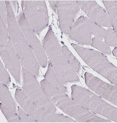 Immunohistochemistry-Paraffin: CD45 Antibody (CL0160) [NBP2-14783] -Staining of human skeletal muscle shows no positivity in myocytes as expected.
