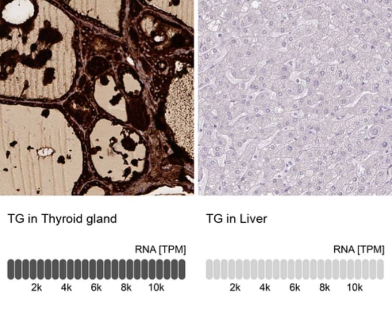 <b>Orthogonal Strategies Validation. </b>Analysis in human thyroid gland and liver tissues using NBP2-14784 antibody. Corresponding TG RNA-seq data are presented for the same tissues.