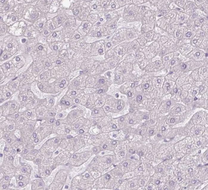 Staining of human liver shows no positivity in hepatocytes as expected.